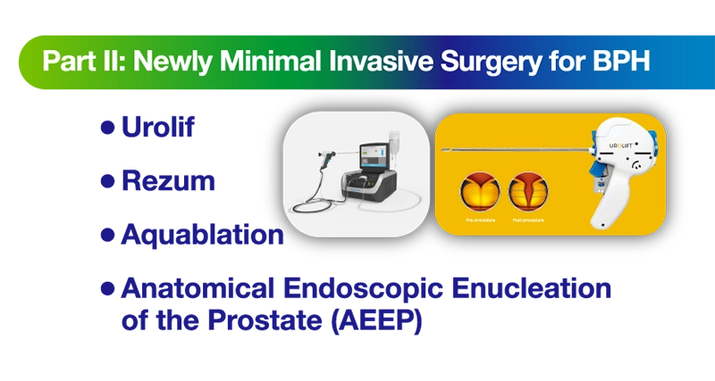 Part II: Newly Minimal Invasive Surgery for BPH